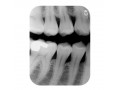Digital vs Conventional Radiography in your Dental Office