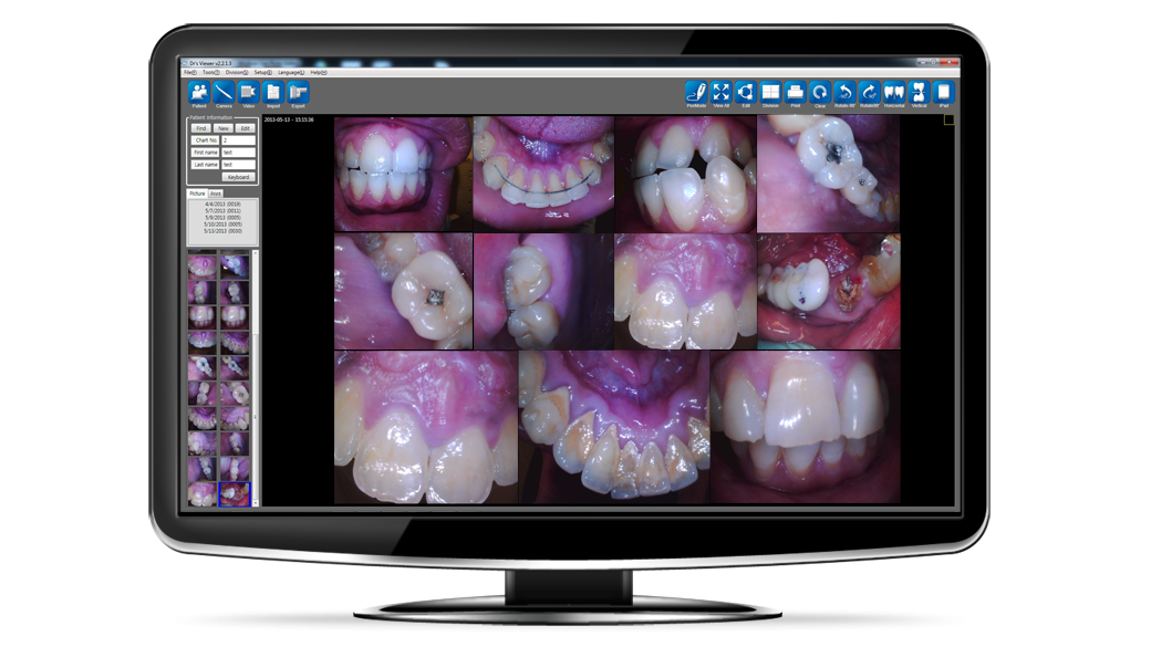 Intraoral Sample 1