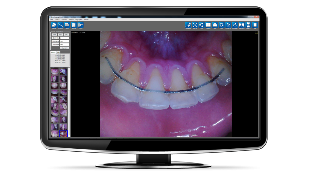 Intraoral Sample 6