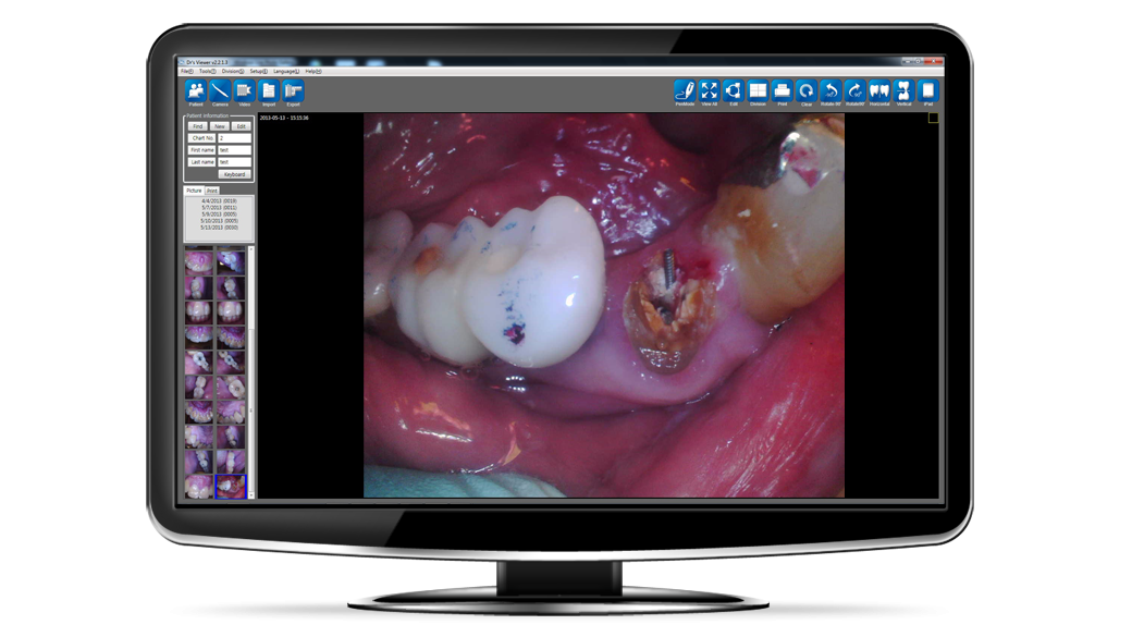 Intraoral Sample 3