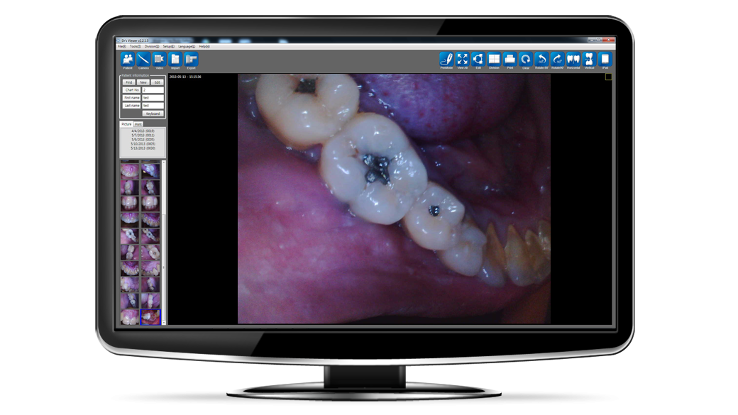 Intraoral Sample 4