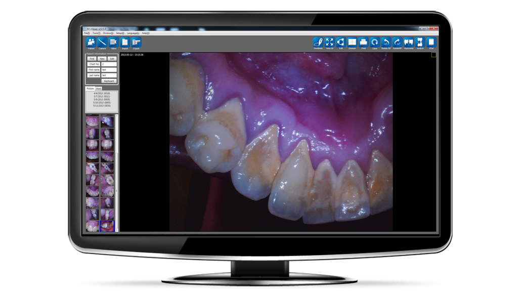 Intraoral Sample 5